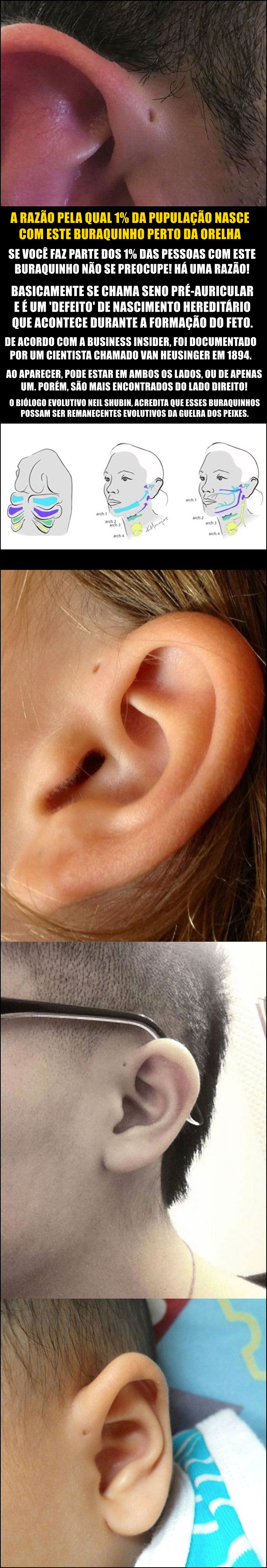 Curiosidade: Você tem aquele buraquinho perto da orelha?